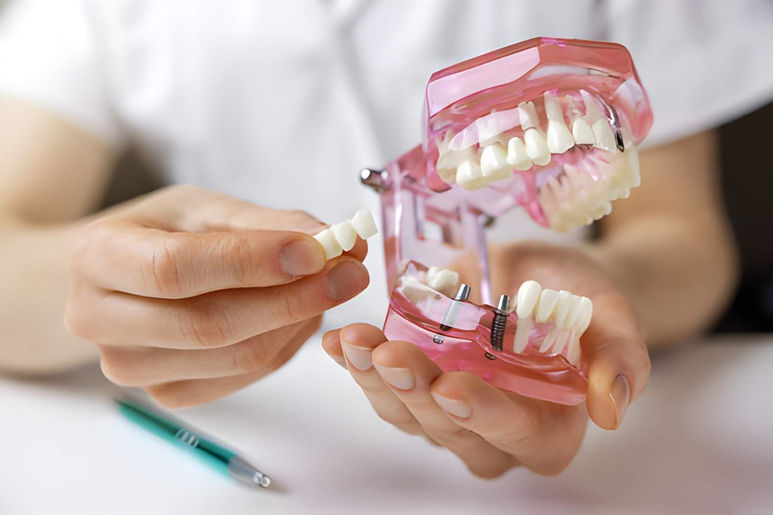 Dental bridges in Shapur